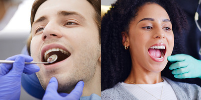colored-fillings